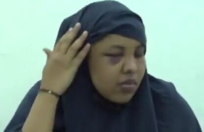 Shocking Eastleigh Attack: Woman Brutally Assaulted by Brother