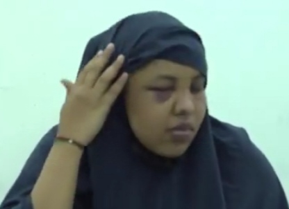 Shocking Eastleigh Attack: Woman Brutally Assaulted by Brother